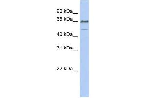 Image no. 1 for anti-DiGeorge Syndrome Chromosome Region-2 (DGS2) (N-Term) antibody (ABIN2782667)