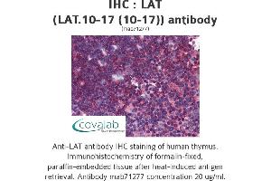 Image no. 2 for anti-Linker For Activation of T Cells (LAT) antibody (ABIN1724096)