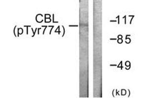 Western blot analysis of extracts from HeLa cells treated with EGF 200ng/ml 30', using CBL (Phospho-Tyr774) Antibody.