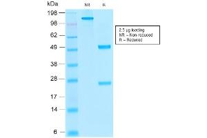 Image no. 3 for anti-Thrombomodulin (THBD) (AA 69-194) antibody (ABIN6383796)