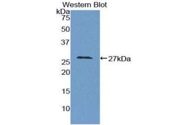 anti-Growth Arrest-Specific 2 (GAS2) (AA 64-267) antibody