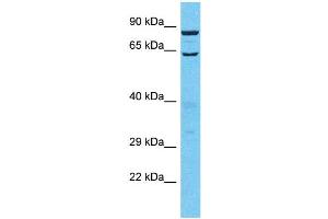 Image no. 1 for anti-Tubulin Tyrosine Ligase-Like Family, Member 13 (TTLL13) (C-Term) antibody (ABIN2791971)