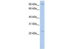 Image no. 1 for anti-Oxysterol Binding Protein-Like 8 (OSBPL8) (N-Term) antibody (ABIN6740875)