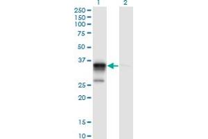 Western Blot analysis of ACOT8 expression in transfected 293T cell line by ACOT8 monoclonal antibody (M03), clone 3F1.