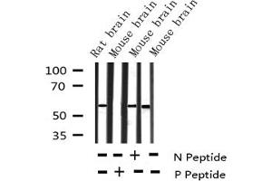 Image no. 4 for anti-Tyrosine Hydroxylase (TH) (pSer40) antibody (ABIN6255304)