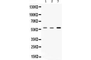 Image no. 2 for anti-Catalase (CAT) (AA 344-527) antibody (ABIN4886504)