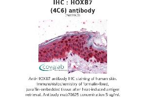 Image no. 2 for anti-Homeobox B7 (HOXB7) (AA 55-121) antibody (ABIN1723482)