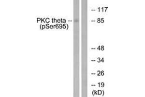 Western blot analysis of extracts from Jurkat cells treated with EGF 200ng/ml 15', using PKC thet (Phospho-Ser695) Antibody.