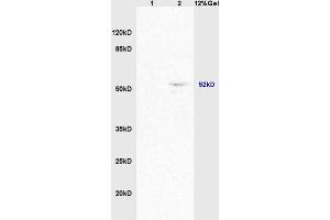 Image no. 3 for anti-Activin Receptor Type 1C (ACVR1C) (AA 21-120) antibody (ABIN714596)
