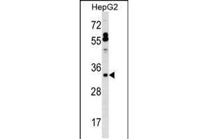 Image no. 1 for anti-Surfactant Protein B (SFTPB) (AA 129-158) antibody (ABIN5537428)