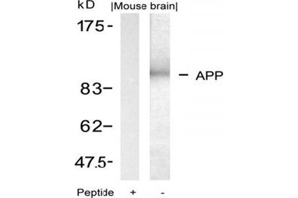 anti-Amyloid beta (A4) Precursor Protein (APP) (AA 666-670) antibody
