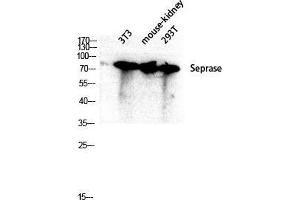 Image no. 2 for anti-Fibroblast Activation Protein, alpha (FAP) (Internal Region) antibody (ABIN3186906)