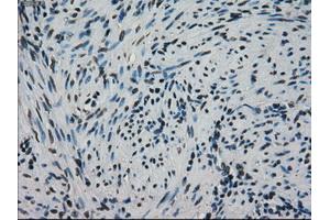 Image no. 2 for anti-Heat Shock 70kDa Protein 9 (Mortalin) (HSPA9) antibody (ABIN2722258)