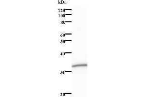 Image no. 1 for anti-Septin 11 (SEPT11) antibody (ABIN931249)