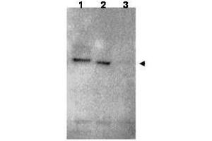 Western blot using  affinity purified anti-RNF25 antibody shows detection of RNF25 (arrow head) in HEK293 cells over-expressing human RNF25 (lane 1) or mouse RNF25 (lane 2).
