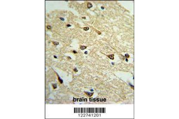 anti-Adenylate Cyclase 8 (Brain) (ADCY8) (AA 946-972) antibody