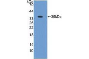 Image no. 1 for anti-Protein Kinase C, beta 1 (Pkc beta 1) antibody (ABIN2921977)