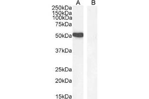 Image no. 3 for anti-GATA Binding Protein 1 (Globin Transcription Factor 1) (GATA1) (Internal Region) antibody (ABIN185449)