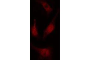 Image no. 1 for anti-Pre-mRNA Processing Factor 19 (PRPF19) antibody (ABIN6259137)
