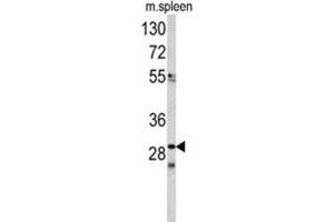 Image no. 3 for anti-Cell Division Cycle Associated 3 (CDCA3) antibody (ABIN3002713)