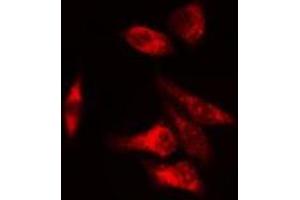 Image no. 2 for anti-UDP-Glucose 6-Dehydrogenase (UGDH) antibody (ABIN6258930)