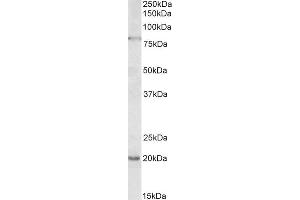 Image no. 1 for anti-2'-5'-Oligoadenylate Synthetase 2, 69/71kDa (OAS2) (Internal Region) antibody (ABIN1782145)