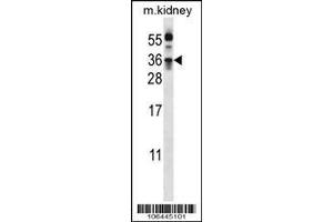Image no. 1 for anti-Kallikrein 8 (KLK8) (Center) antibody (ABIN2490062)