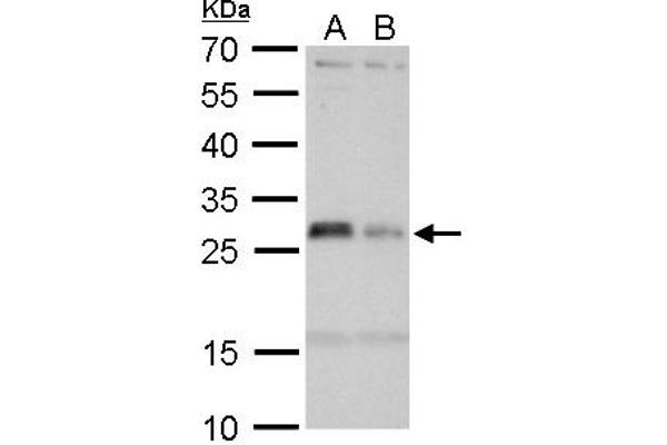 HLA-DMA antibody  (Center)
