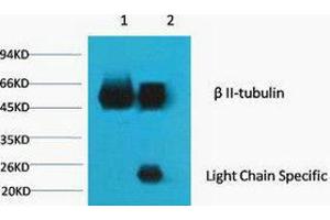 Image no. 2 for anti-Tubulin, beta 2A (TUBB2A) antibody (ABIN3181221)