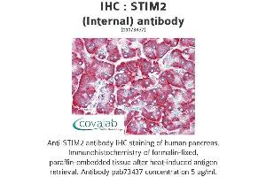 Image no. 2 for anti-Stromal Interaction Molecule 2 (Stim2) (Internal Region) antibody (ABIN1739718)