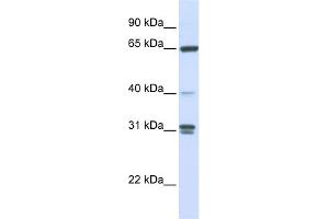 Image no. 1 for anti-Guanylate Binding Protein 2, Interferon-Inducible (GBP2) (N-Term) antibody (ABIN2785847)