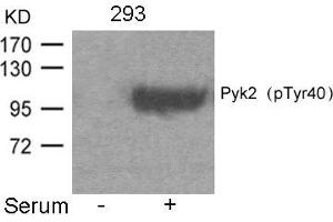 PTK2B 抗体  (pTyr402)