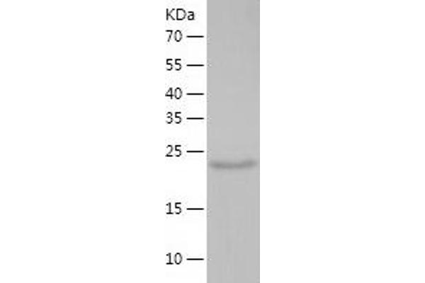 Methyltransferase Like 21D (METTL21D) (AA 1-229) protein (His tag)