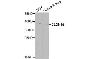 Western blot analysis of extracts of various cell lines, using CLDN16 Antibody (ABIN6003594) at 1/1000 dilution.