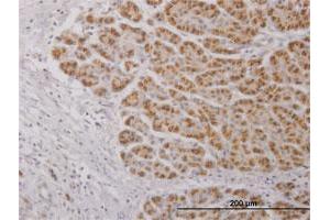 Image no. 3 for anti-Interleukin 17C (IL17C) (AA 1-197) antibody (ABIN1327697)