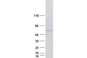 Image no. 1 for Cytochrome P450, Family 11, Subfamily B, Polypeptide 1 (CYP11B1) (Transcript Variant 2) protein (Myc-DYKDDDDK Tag) (ABIN2712751)