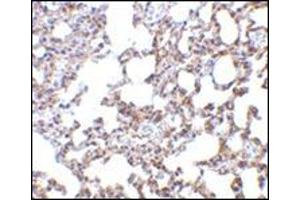 Image no. 1 for anti-SKI-Like Oncogene (SKIL) (N-Term) antibody (ABIN500786)