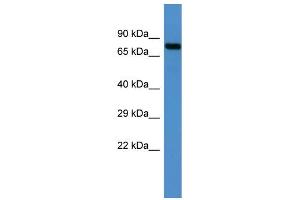 Image no. 1 for anti-Midline 2 (MID2) (C-Term) antibody (ABIN2787427)
