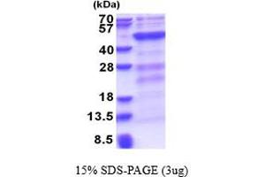Image no. 1 for DNA (Cytosine-5-)-Methyltransferase 3 Like (TRDMT1) (AA 1-387) protein (His tag) (ABIN6387414)