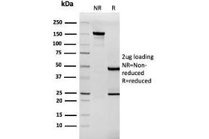 Image no. 1 for anti-Tenascin C (TNC) antibody (ABIN6939676)