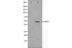 Image no. 1 for anti-Histone Acetyltransferase 1 (HAT1) (C-Term) antibody (ABIN6262150)