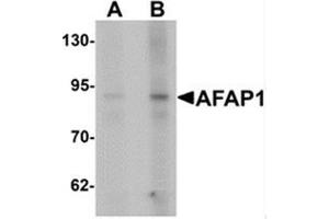 Image no. 1 for anti-Actin Filament Associated Protein 1 (AFAP1) (N-Term) antibody (ABIN1450096)