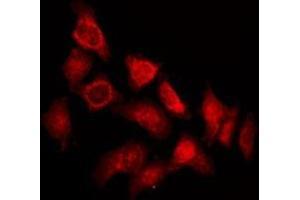 Image no. 1 for anti-Testis Specific Serine Kinase 4 (TSSK4) (Internal Region) antibody (ABIN6257851)