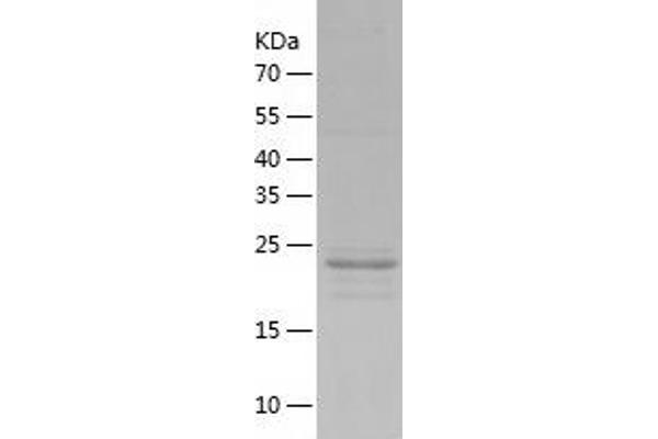 OTUB2 Protein (AA 1-234) (His tag)