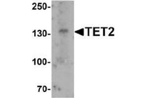 Image no. 1 for anti-Tet Methylcytosine Dioxygenase 2 (TET2) (N-Term) antibody (ABIN1450172)