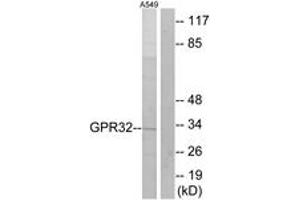 GPR32 抗体  (AA 151-200)