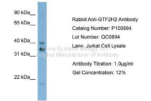 GTF2H2 Antikörper  (C-Term)