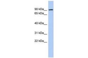 Image no. 1 for anti-Aldehyde Dehydrogenase 18 Family, Member A1 (ALDH18A1) (AA 35-84) antibody (ABIN6744012)