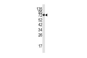 Western Blotting (WB) image for anti-Adenosine Monophosphate Deaminase 3 (AMPD3) (Center) antibody (ABIN2159096)