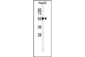 Image no. 3 for anti-Cathepsin H (CTSH) (AA 32-62), (N-Term) antibody (ABIN452890)